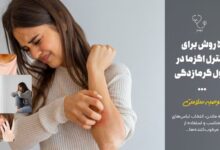 ۵ روش برای کنترل اگزما در طول گرمازدگی ...