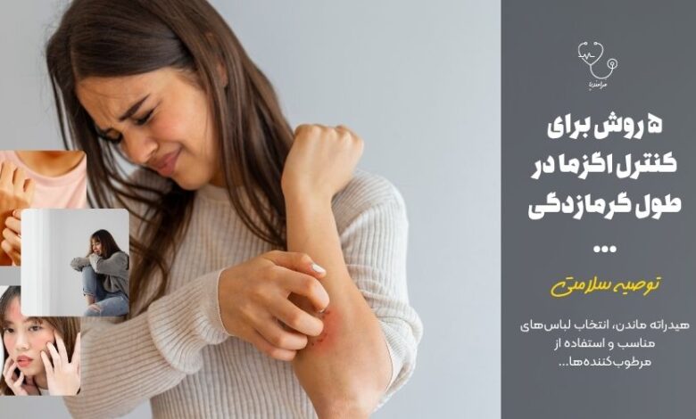 ۵ روش برای کنترل اگزما در طول گرمازدگی ...